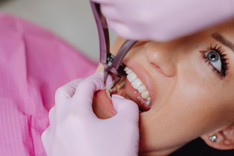 Tang gigi atau forceps, Sumber: pexels.com